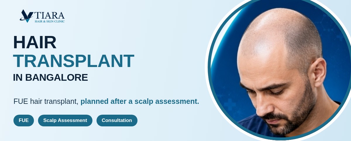 FUE Hair Transplant in Bangalore at VTIARA Hair & Skin Clinic