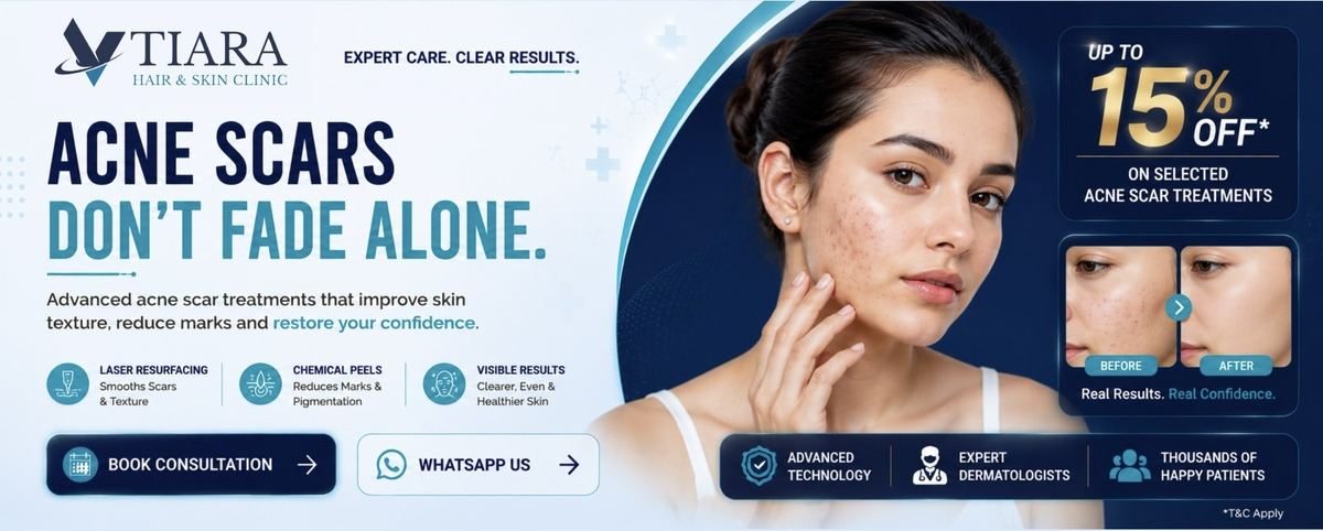 Acne Scars Don't Fade Alone – Acne Scar Treatment at VTIARA