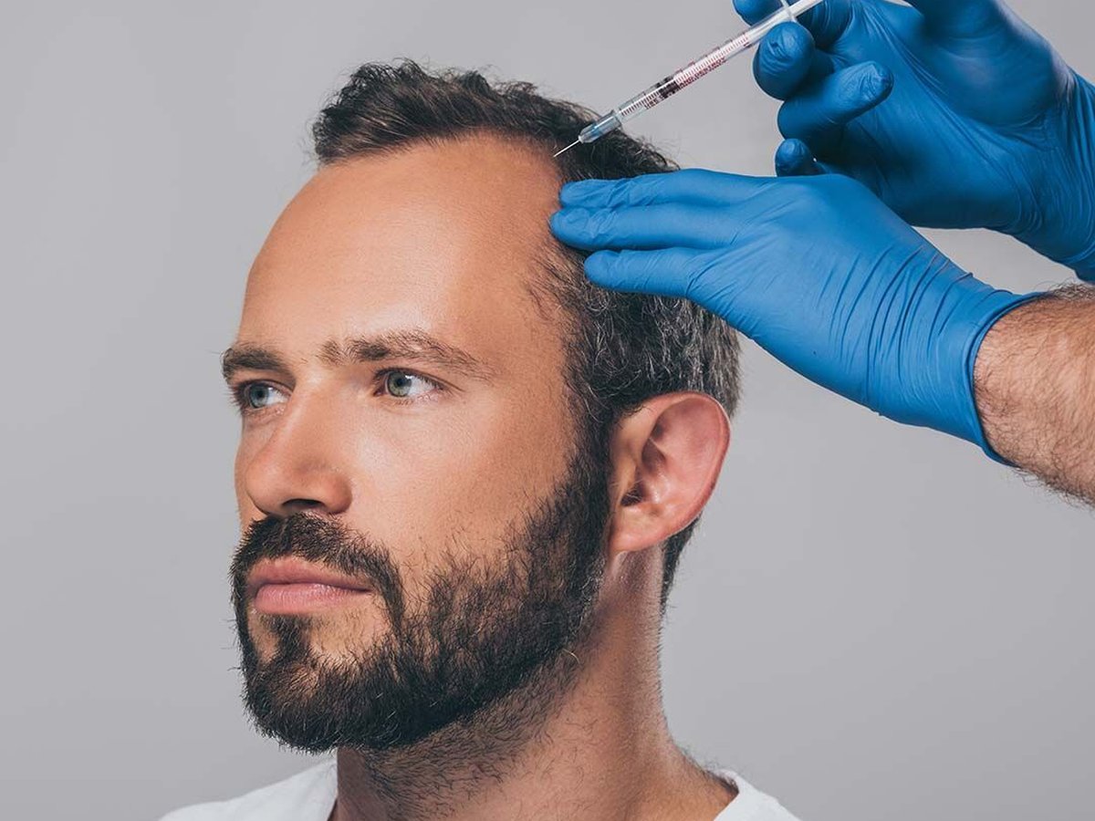 PRP Hair Treatment