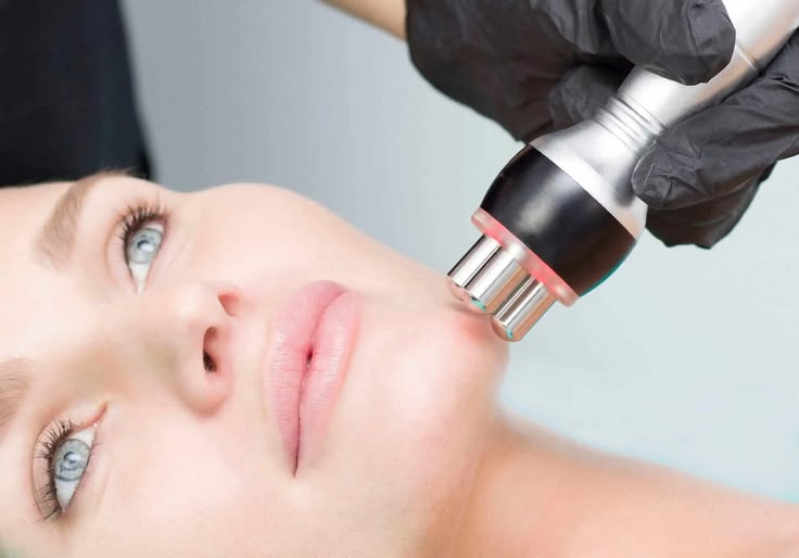 Skin Tightening