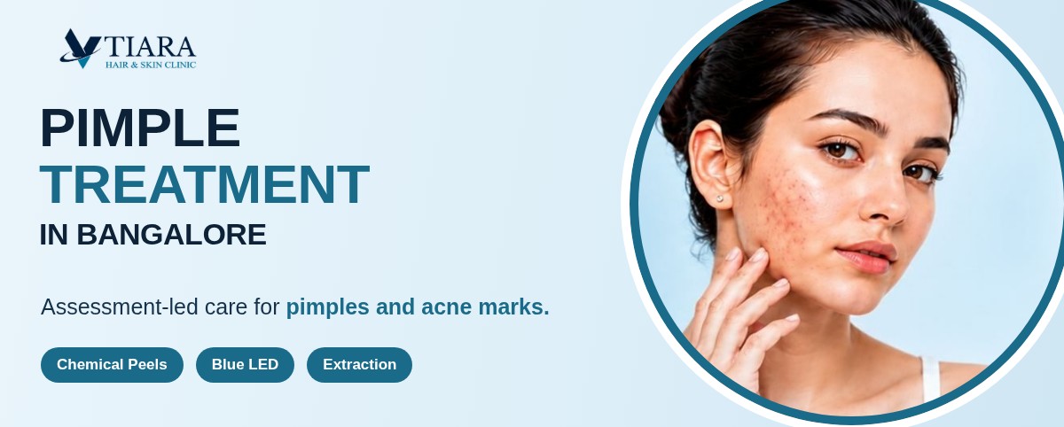 Pimple Treatment in Bangalore at VTIARA Hair & Skin Clinic
