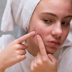 acne pimple treatment in bangalore